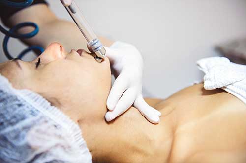 Peeling de diamante ponteira com cristais de diamante realiza peeling em rosto feminino